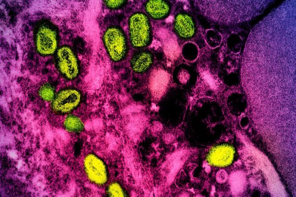 Feds Suspiciously Revive the Name ‘Monkeypox’ After Dropping It in 2022 – In-Depth Review and Pra…