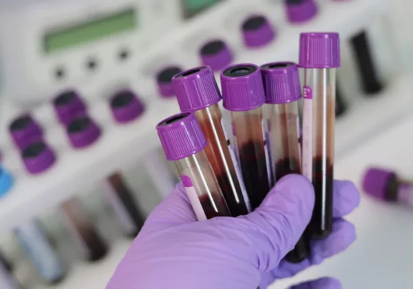 Simple Blood Test Could Dramatically Boost Alzheimer’s Diagnosis Accuracy